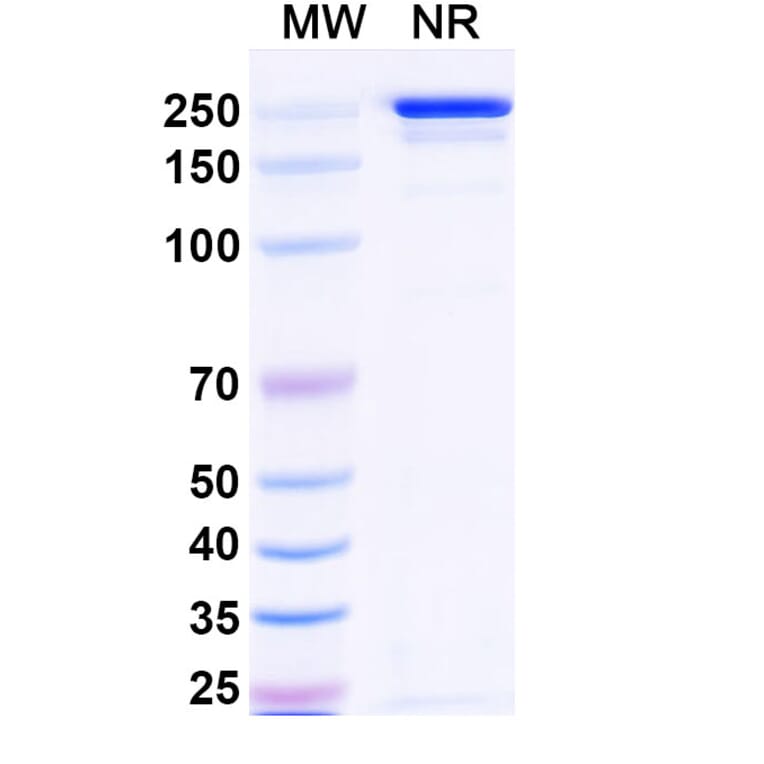 SDS-PAGE - Tazlestobart Biosimilar - Anti-CTLA-4 Antibody - BSA and Azide free (A340746) - Antibodies.com
