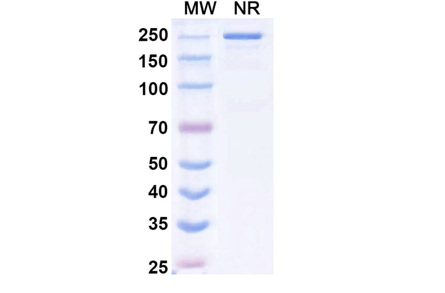 SDS-PAGE - Tazlestobart Biosimilar - Anti-CTLA-4 Antibody - BSA and Azide free (A340746) - Antibodies.com