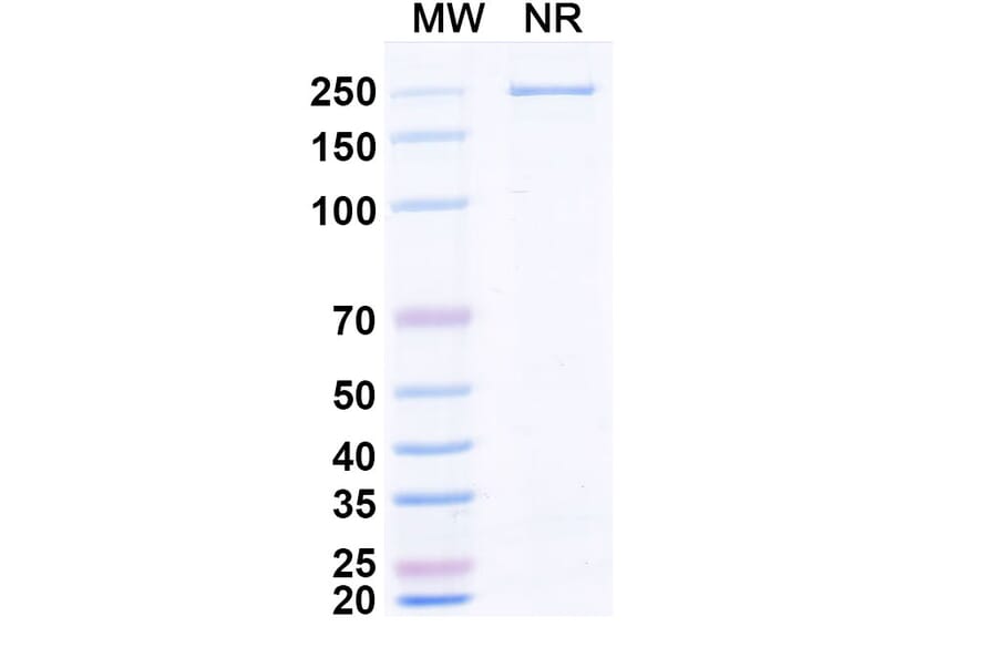 SDS-PAGE - Zaltenibart Biosimilar - Anti-MASP1 Antibody - BSA and Azide free (A340751) - Antibodies.com