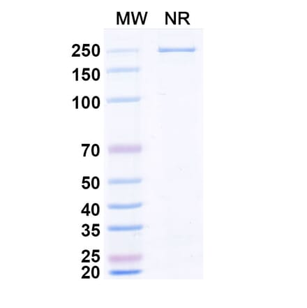 SDS-PAGE - Zaltenibart Biosimilar - Anti-MASP1 Antibody - BSA and Azide free (A340751) - Antibodies.com