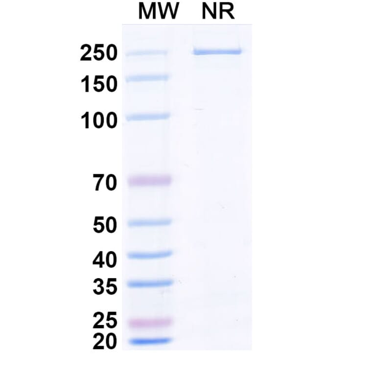 SDS-PAGE - Zaltenibart Biosimilar - Anti-MASP1 Antibody - BSA and Azide free (A340751) - Antibodies.com
