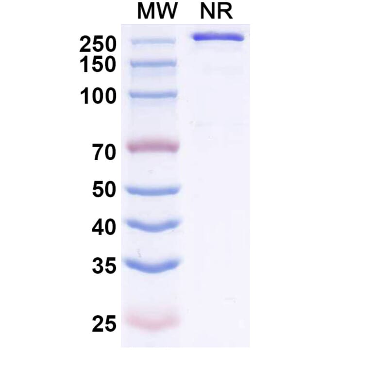 SDS-PAGE - Zaltenibart Biosimilar - Anti-MASP1 Antibody - BSA and Azide free (A340751) - Antibodies.com