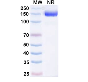 SDS-PAGE - Efparepoetin Alfa Biosimilar - Anti-EPO Antibody - BSA and Azide free (A340757) - Antibodies.com
