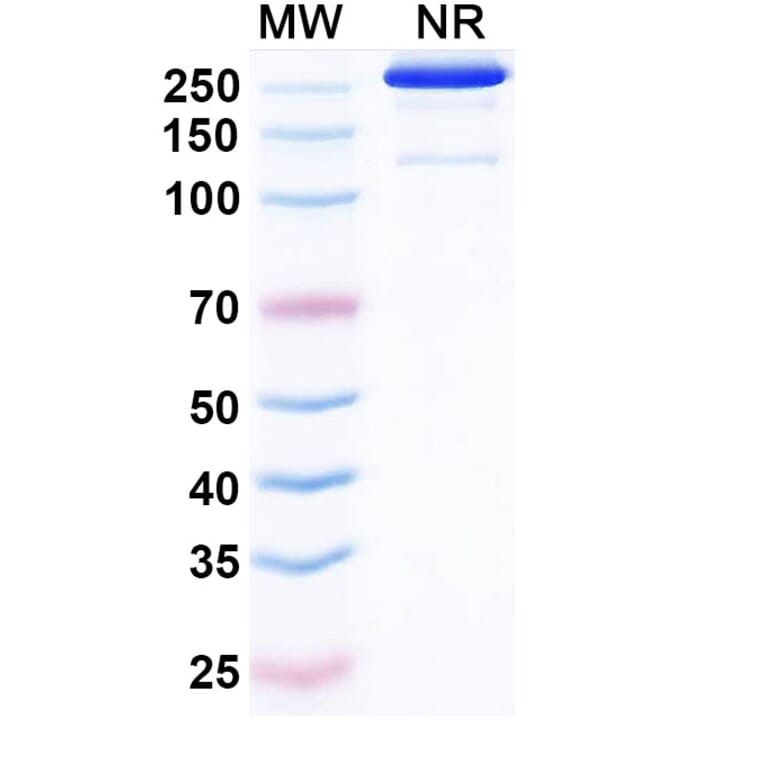 SDS-PAGE - Etakafusp Alfa Biosimilar - Anti-CD8 alpha Antibody - BSA and Azide free (A340758) - Antibodies.com