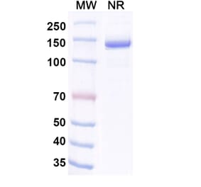 SDS-PAGE - Invikafusp Alfa Biosimilar - Anti-IL-2 Antibody - BSA and Azide free (A340760) - Antibodies.com