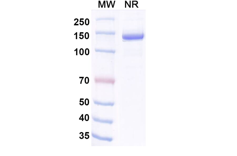 SDS-PAGE - Invikafusp Alfa Biosimilar - Anti-IL-2 Antibody - BSA and Azide free (A340760) - Antibodies.com