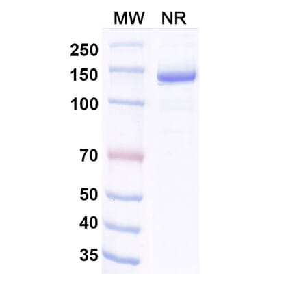 SDS-PAGE - Invikafusp Alfa Biosimilar - Anti-IL-2 Antibody - BSA and Azide free (A340760) - Antibodies.com