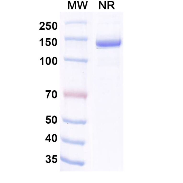 SDS-PAGE - Invikafusp Alfa Biosimilar - Anti-IL-2 Antibody - BSA and Azide free (A340760) - Antibodies.com