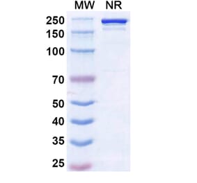 SDS-PAGE - Ruxoprubart Biosimilar - Anti-Complement Factor B Antibody - BSA and Azide free (A340768) - Antibodies.com