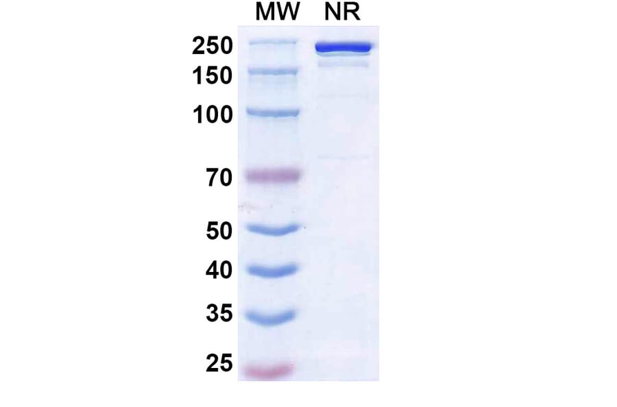 SDS-PAGE - Ruxoprubart Biosimilar - Anti-Complement Factor B Antibody - BSA and Azide free (A340768) - Antibodies.com