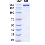 SDS-PAGE - Ruxoprubart Biosimilar - Anti-Complement Factor B Antibody - BSA and Azide free (A340768) - Antibodies.com