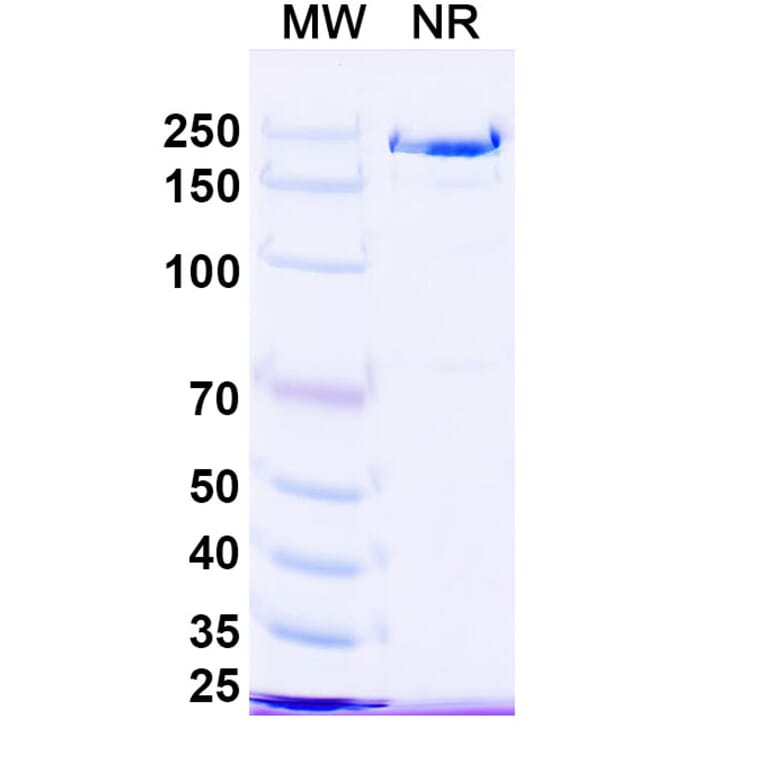 SDS-PAGE - Ruxoprubart Biosimilar - Anti-Complement Factor B Antibody - BSA and Azide free (A340768) - Antibodies.com