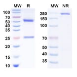 SDS-PAGE - Anti-CD40 Antibody [Emory U. anti-CD4] Biosimilar - BSA and Azide free (A340808) - Antibodies.com