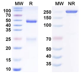 SDS-PAGE - Anti-DDR1 Antibody [Imperial College anti-DDR1] Biosimilar - BSA and Azide free (A340812) - Antibodies.com