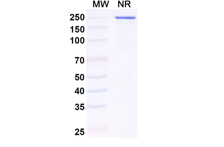 SDS-PAGE - Anti-IL-11RA Antibody [LASN 1] Biosimilar - BSA and Azide free (A340847) - Antibodies.com