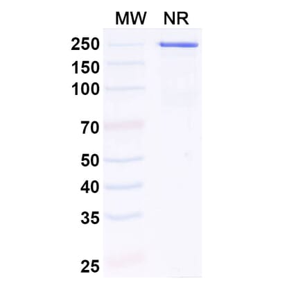 SDS-PAGE - Anti-IL-11RA Antibody [LASN 1] Biosimilar - BSA and Azide free (A340847) - Antibodies.com