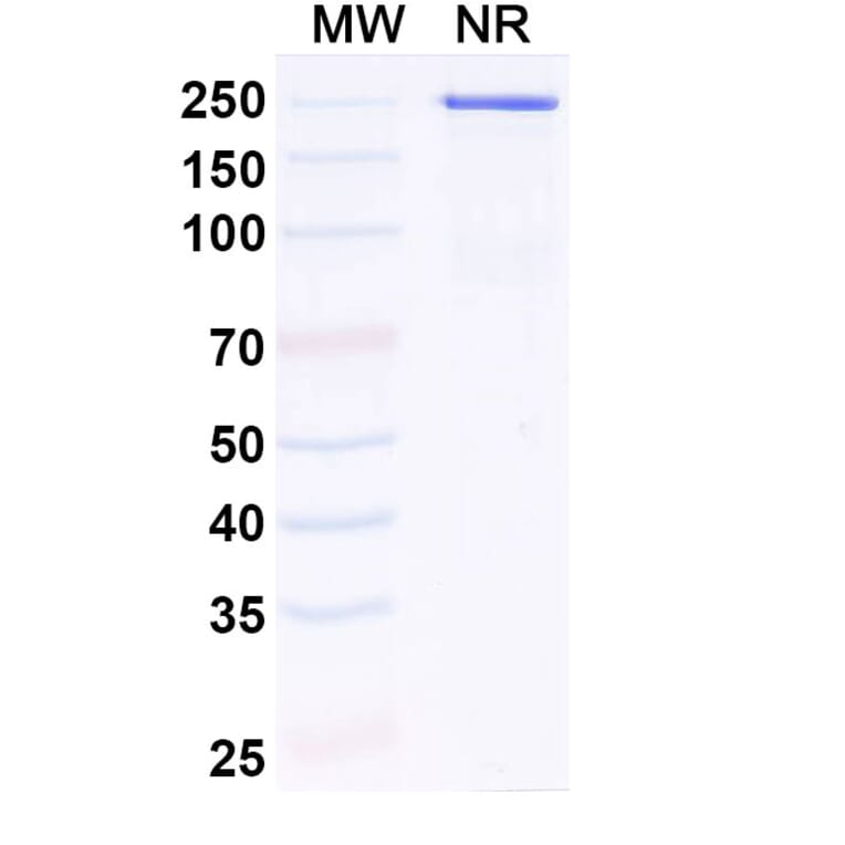 SDS-PAGE - Anti-IL-11RA Antibody [LASN 1] Biosimilar - BSA and Azide free (A340847) - Antibodies.com