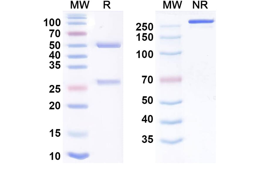 SDS-PAGE - imneskibart Biosimilar - Anti-CD25 Antibody - BSA and Azide free (A340904) - Antibodies.com