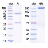 SDS-PAGE - cliramitug Biosimilar - Anti-Prealbumin Antibody - BSA and Azide free (A340907) - Antibodies.com