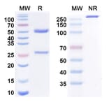 SDS-PAGE - cenvacibart Biosimilar - Anti-Factor XI Antibody - BSA and Azide free (A340914) - Antibodies.com