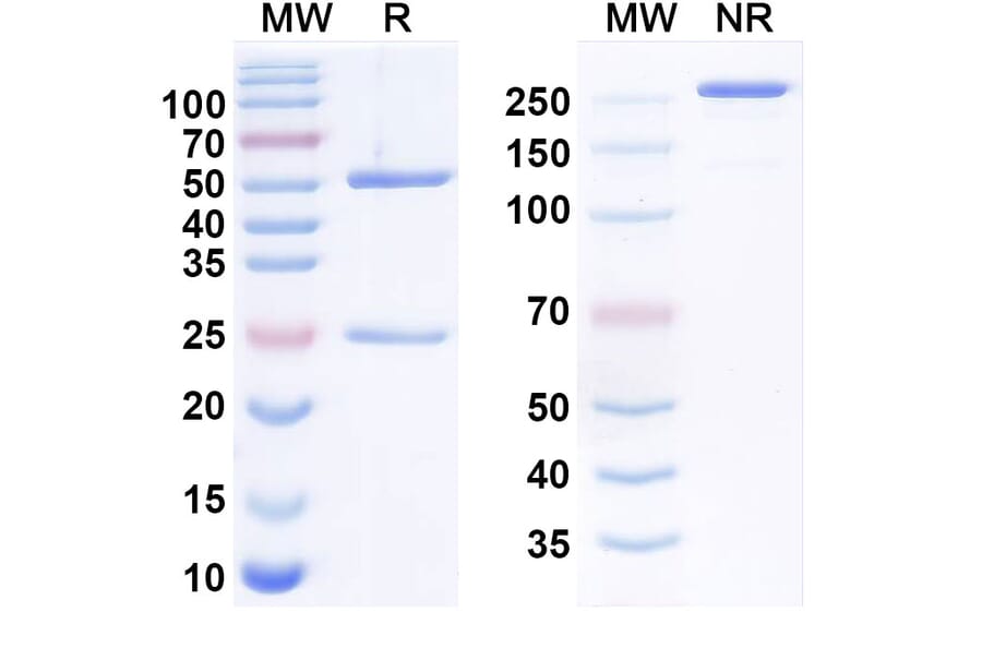 SDS-PAGE - baloncibart Biosimilar - Anti-NPR1 Antibody - BSA and Azide free (A340943) - Antibodies.com