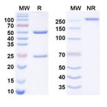 SDS-PAGE - telikibart Biosimilar - Anti-IL-4R Antibody - BSA and Azide free (A340959) - Antibodies.com