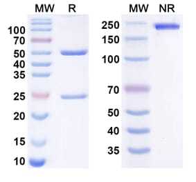 SDS-PAGE - balertatug Biosimilar - Anti-CD70 Antibody - BSA and Azide free (A340968) - Antibodies.com