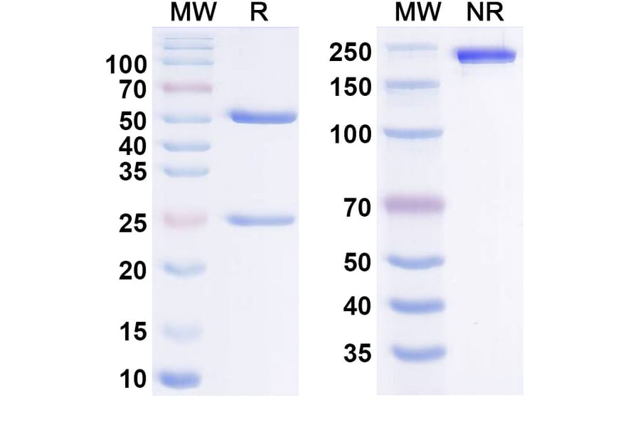 SDS-PAGE - eltivutabart Biosimilar - Anti-CD39 Antibody - BSA and Azide free (A340979) - Antibodies.com