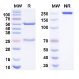 SDS-PAGE - garetatug Biosimilar - Anti-Claudin18 Antibody - BSA and Azide free (A340987) - Antibodies.com