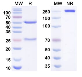 SDS-PAGE - balekafusp alfa Biosimilar - Anti-IL-2 Antibody - BSA and Azide free (A340989) - Antibodies.com