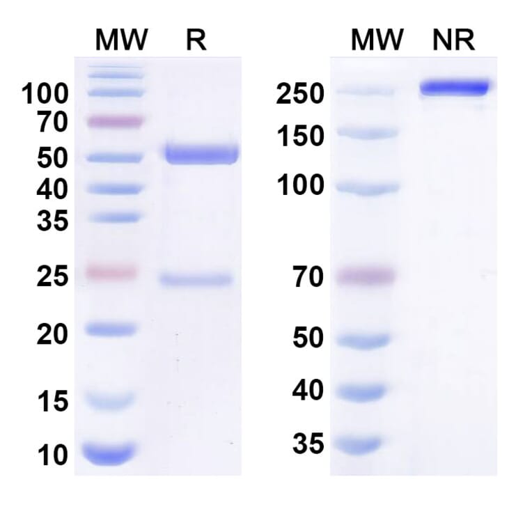 SDS-PAGE - aletekitug Biosimilar - Anti-IL-18 Antibody - BSA and Azide free (A340998) - Antibodies.com