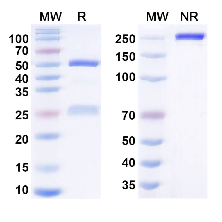 SDS-PAGE - lecankitug Biosimilar - Anti-IL-17A Antibody - BSA and Azide free (A341006) - Antibodies.com