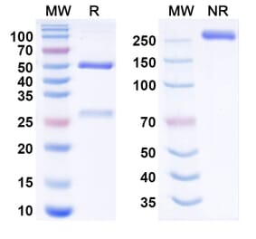 SDS-PAGE - felmetatug Biosimilar - Anti-B7-H4 Antibody - BSA and Azide free (A341011) - Antibodies.com