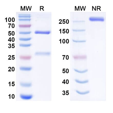 SDS-PAGE - felmetatug Biosimilar - Anti-B7-H4 Antibody - BSA and Azide free (A341011) - Antibodies.com