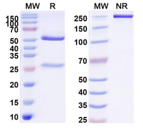 SDS-PAGE - remzistotug Biosimilar - Anti-Nectin 2 Antibody - BSA and Azide free (A341016) - Antibodies.com