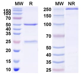 SDS-PAGE - solnerstotug Biosimilar - Anti-VISTA Antibody - BSA and Azide free (A341021) - Antibodies.com