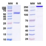 SDS-PAGE - Anti-Glypican 3 + CD3 epsilon Bispecific Antibody [ERY974] (A341045) - Antibodies.com