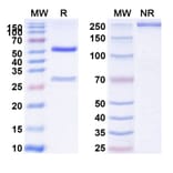 SDS-PAGE - Anti-Integrin alpha V + ITGB6 Bispecific Antibody [7.1G10] (A341076) - Antibodies.com