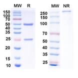 SDS-PAGE - Anti-Envelope Glycoprotein H +gL Complex Bispecific Antibody [E1D1] (A341120) - Antibodies.com