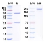 SDS-PAGE - Anti-B7-H3 + EGFR Bispecific Antibody [Ibi-334] (A341180) - Antibodies.com