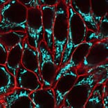 CF®640R - Donkey Anti-Rabbit IgG H&L Antibody (CF®640R), Cross-Adsorbed (A343586) -Antibodies.com