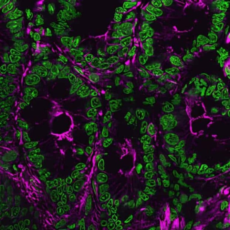 CF®640R - Donkey Anti-Rat IgG H&L Antibody (CF®640R) - Highly Cross-Adsorbed (A343607) -Antibodies.com