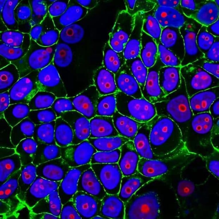 CF®555 - Goat Anti-Mouse IgG2a Antibody (CF®555), Cross-Adsorbed (A343665) -Antibodies.com