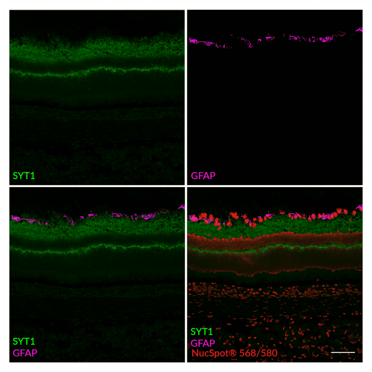 CF®498 - Anti-GFAP Nanobody [SdAb2409.GFAP] (CF®498) (A343785) -Antibodies.com