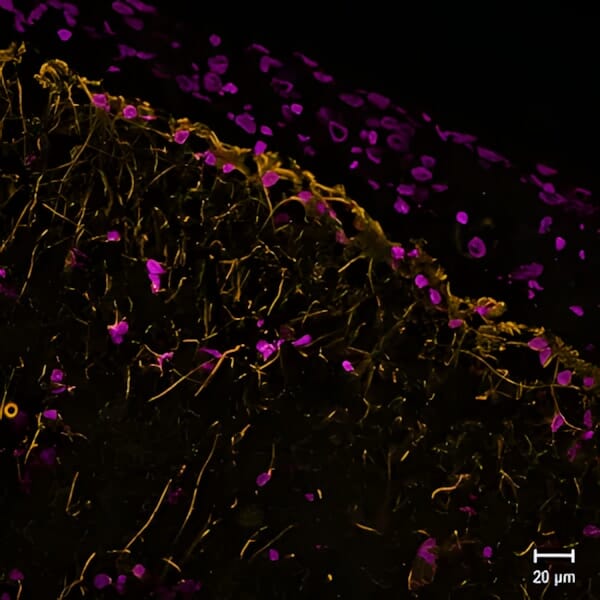 GFAP Antibodies | Antibodies.com