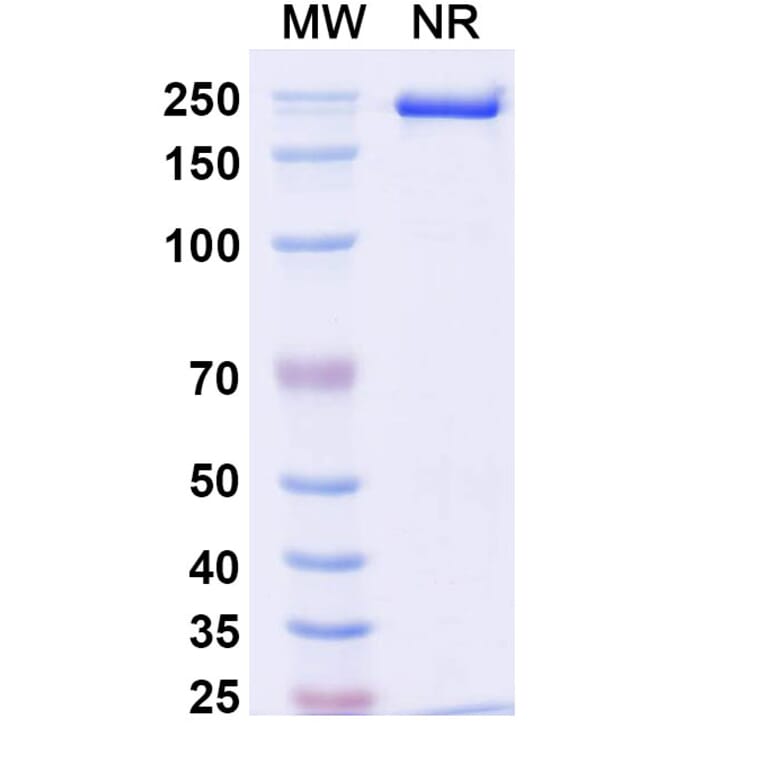 SDS-PAGE - Anti-IL-17A Antibody [Research Grade] [BZN035] - BSA and Azide free (A344105) - Antibodies.com