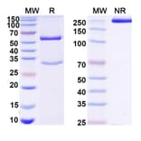 SDS-PAGE - Mouse IgG1 Isotype Control [MOPC-21] - BSA and Azide free (A344120) - Antibodies.com