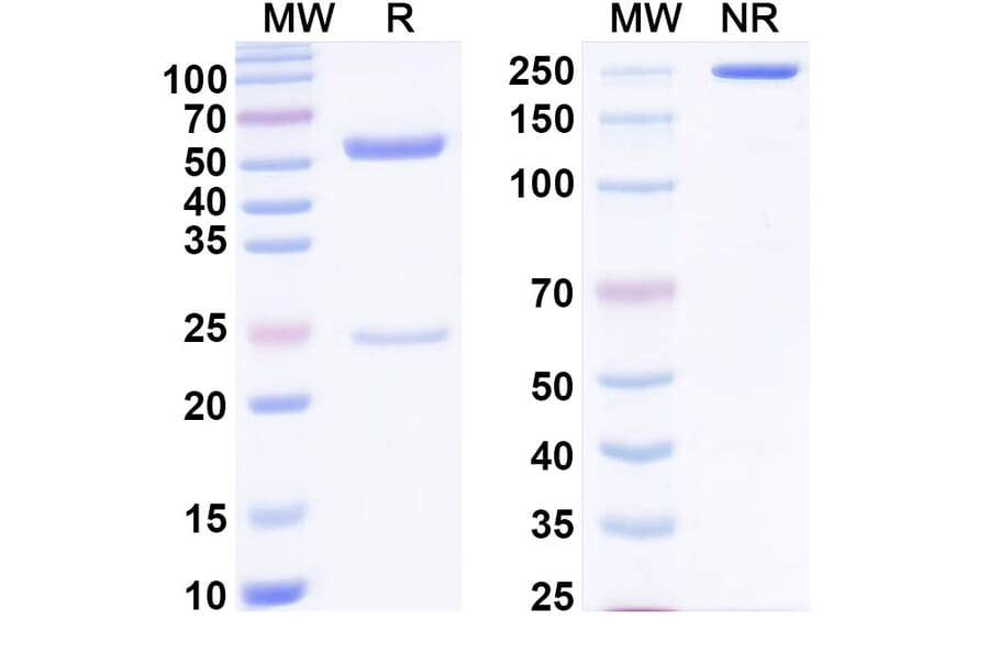 SDS-PAGE - Anti-Factor VIII Antibody [SAA0541] - BSA and Azide free (A344128) - Antibodies.com