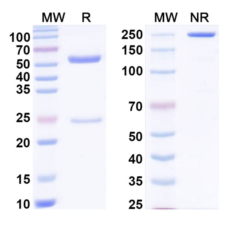 SDS-PAGE - Anti-Factor VIII Antibody [SAA0541] - BSA and Azide free (A344128) - Antibodies.com