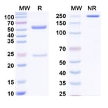 SDS-PAGE - Anti-Factor VIII Antibody [SAA0541] - BSA and Azide free (A344128) - Antibodies.com